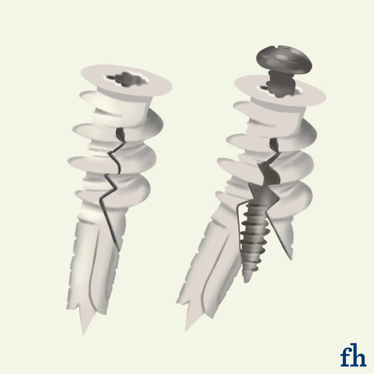 Types Of Drywall Anchors Threaded Drywall Anchors